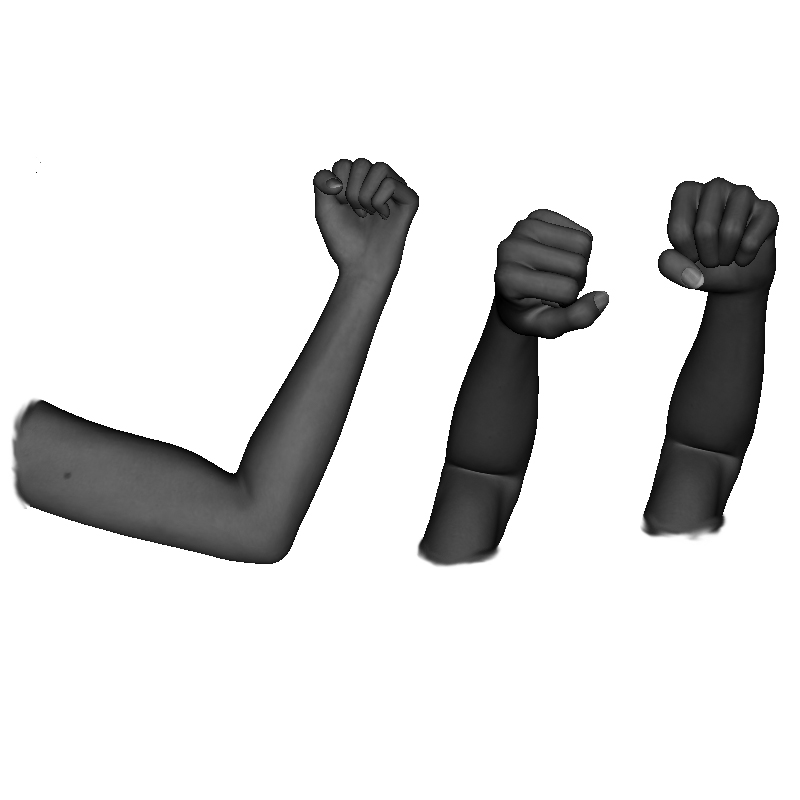 Example of improper inward, vertical forearm formation / alignment not vertical, under / over rotated